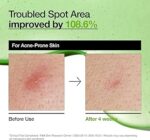 Anua – Azelaic Acid 10 Hyaluron Redness Soothing Serum - 30 ml - Image 3